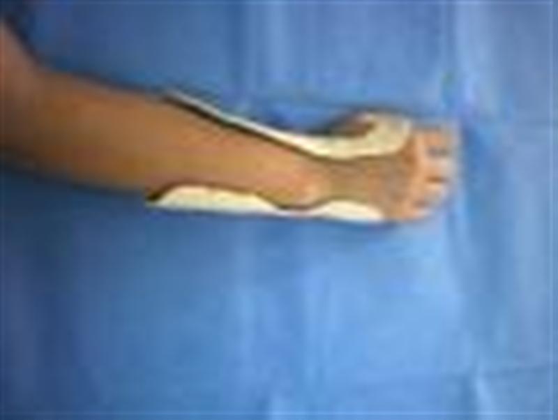 Vente et location d'équipements orthopédiques à Marseille